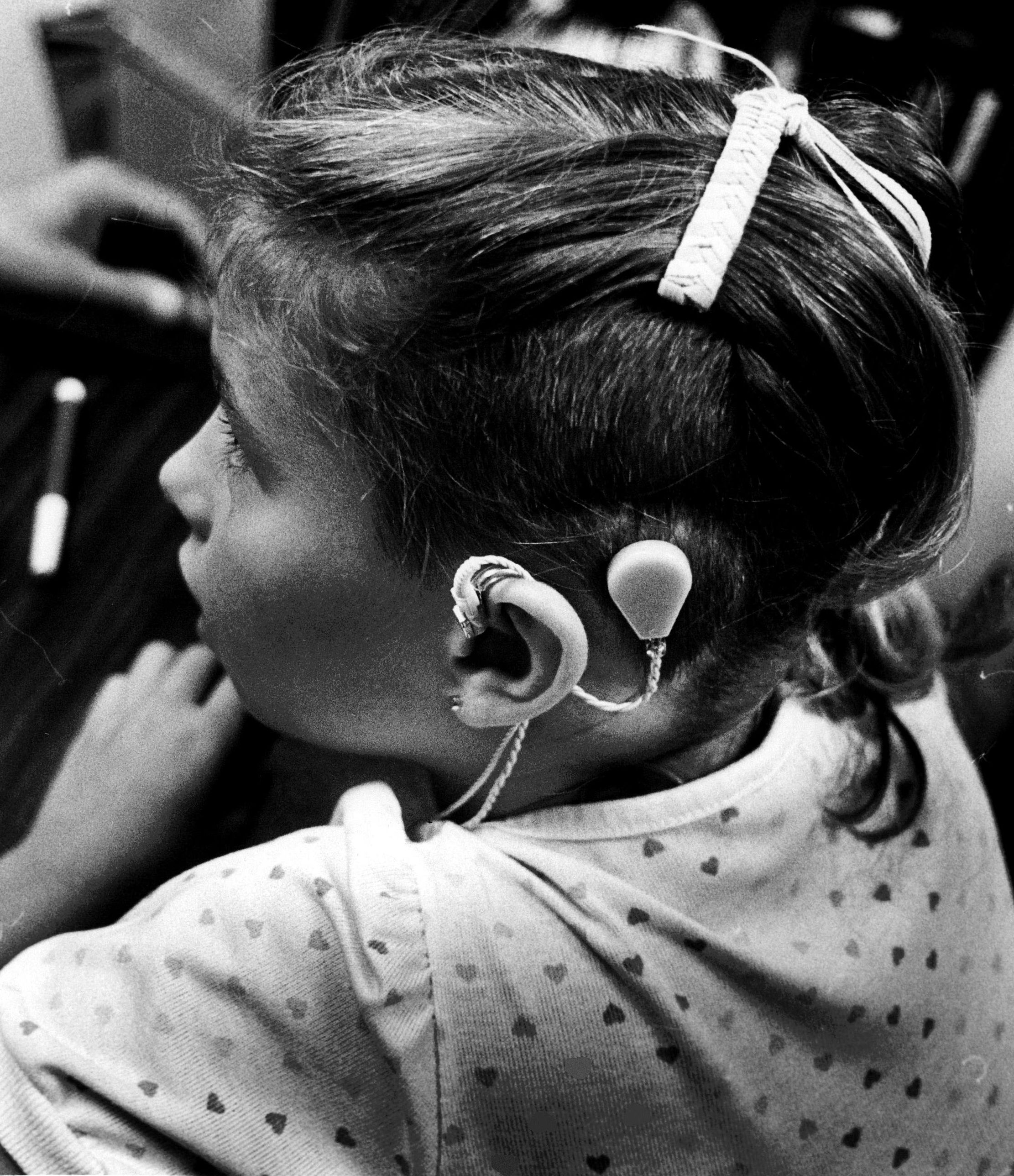 Deaf Culture and Cochlear Implants Genocide or Salvation? Time
