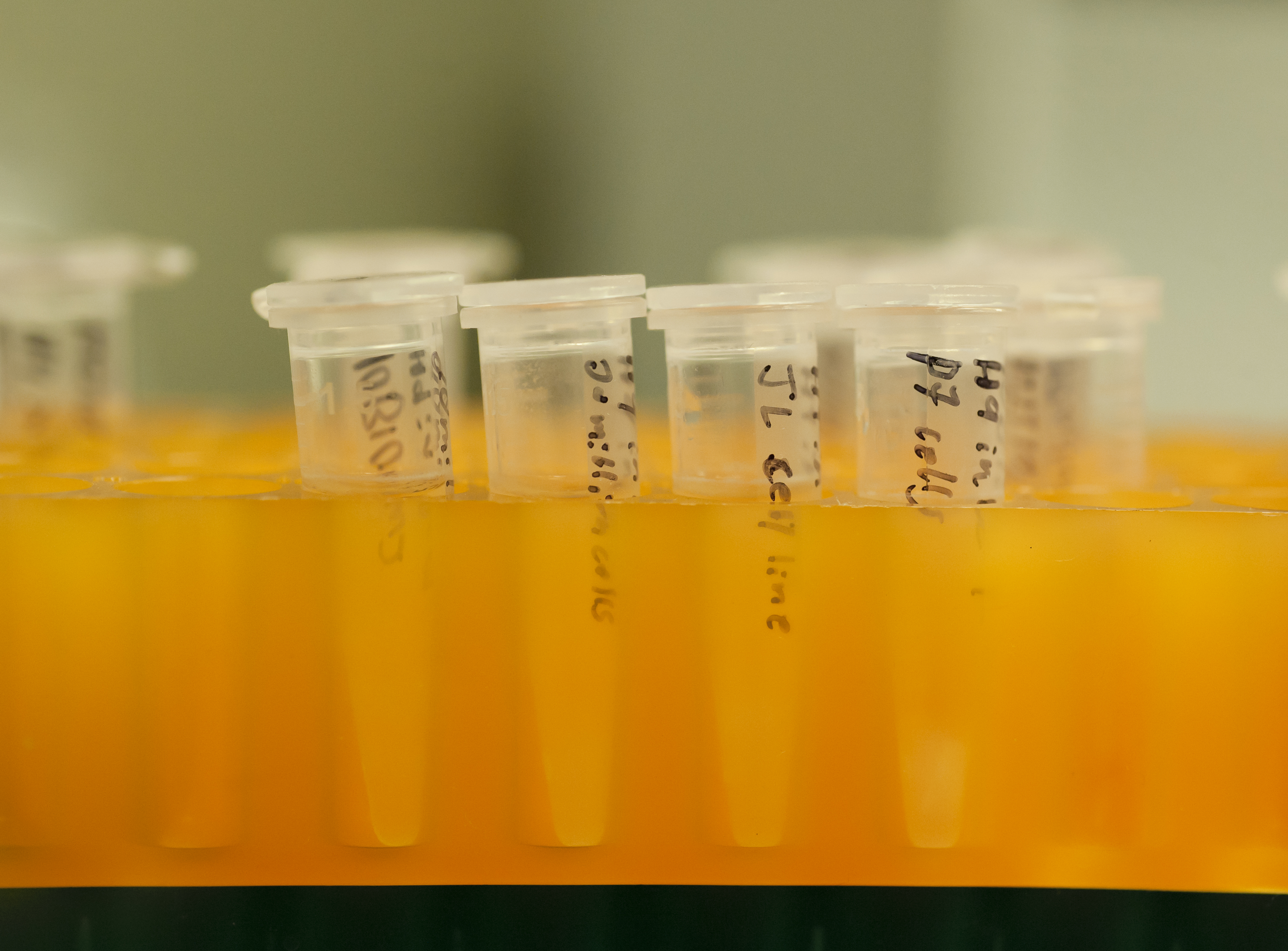 Bloom Syndrome FDA Approves Home Test Kit TIME