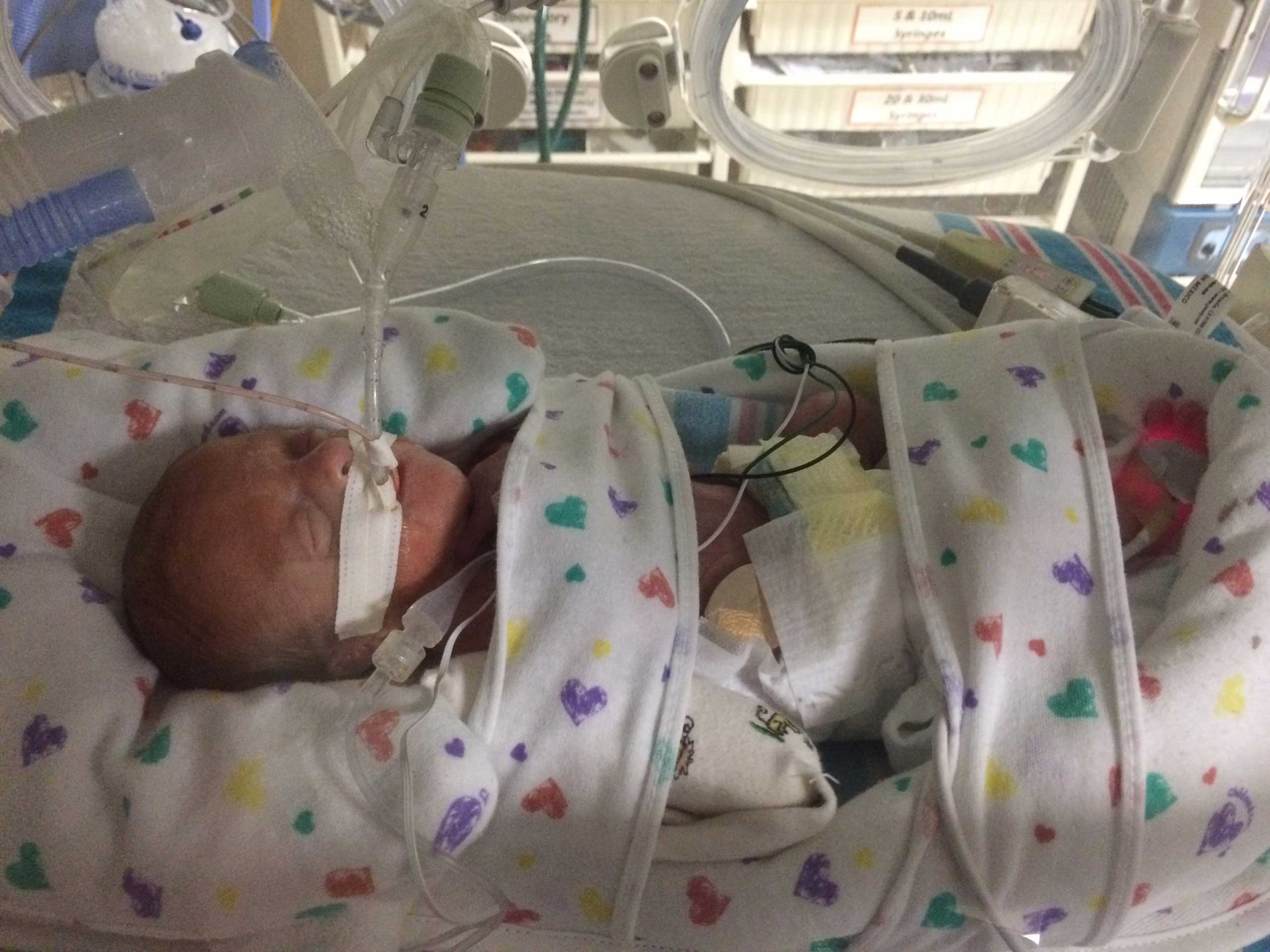 Family Strives to Save Premature Baby Born on Cruise Ship