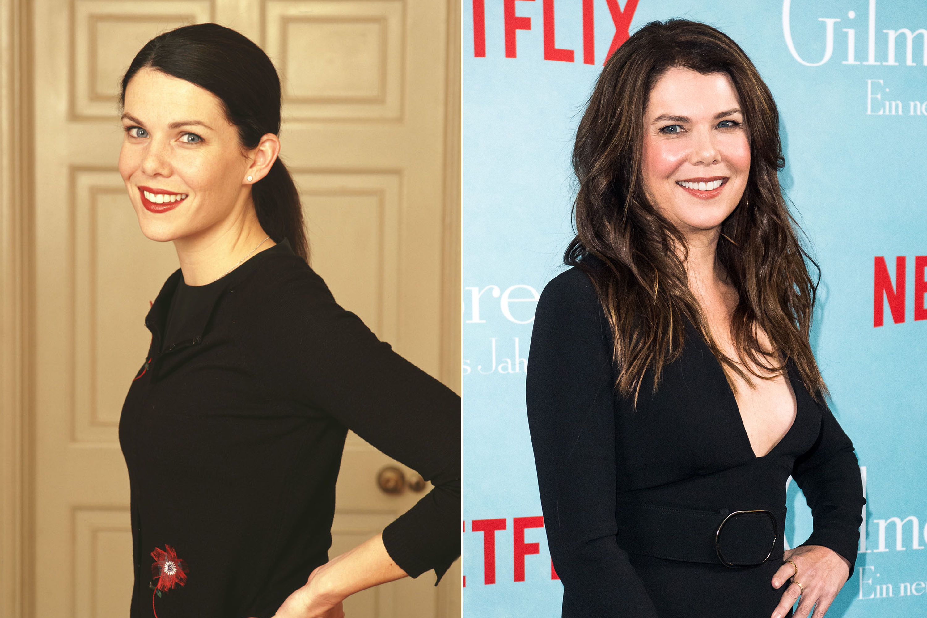 Lauren Graham Nose Job Before And After