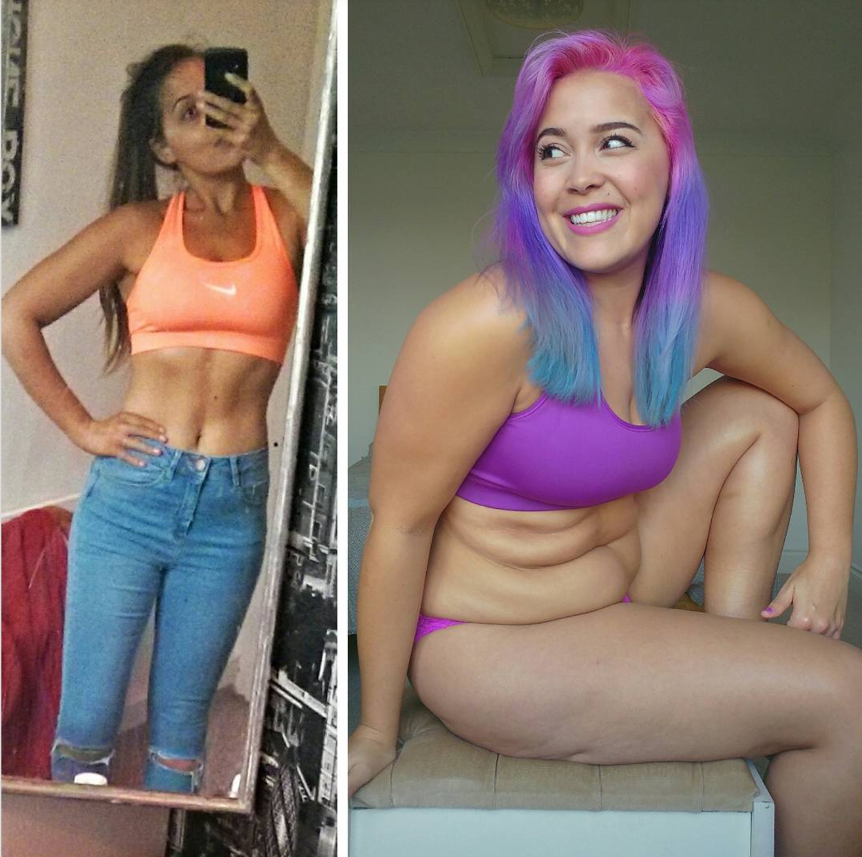 Anorexia Survivor Shows How Gaining Weight Improved Life TIME