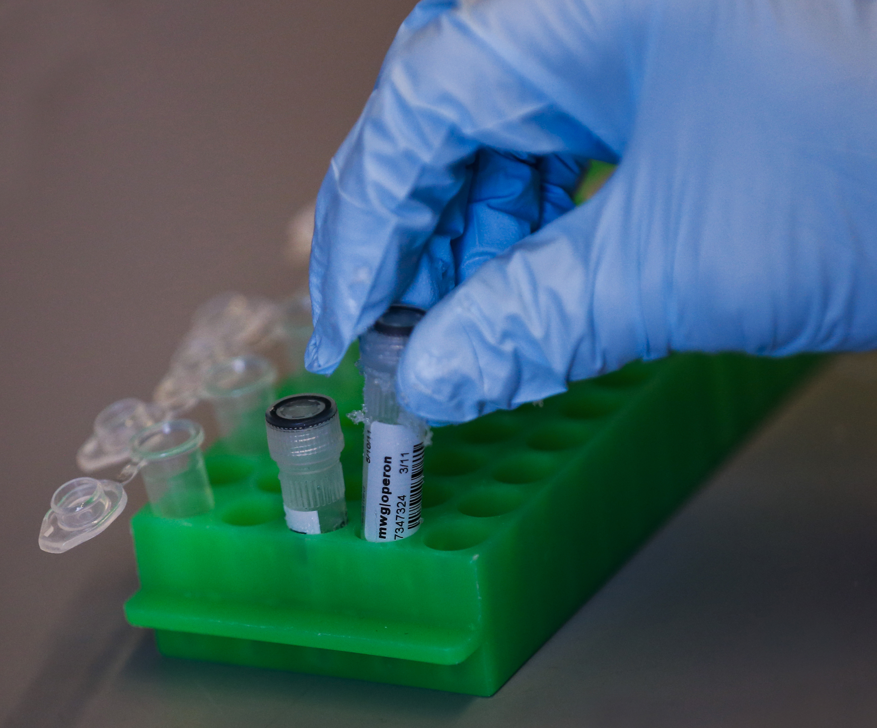 Stem Cell Treatment Grows New Skin for 7YearOld Boy Time