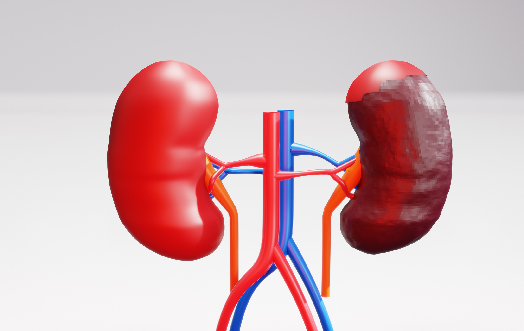 The Latest Kidney Cancer Treatment Advances What to Know TIME