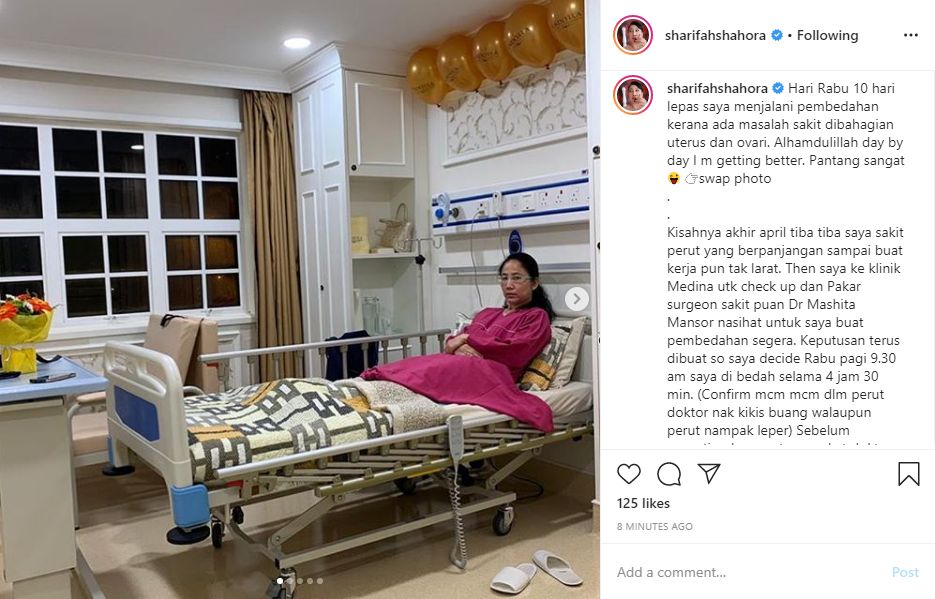 Pembedahan Buang Rahim Polip pangkal rahim atau rahim