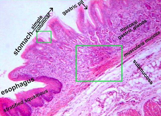Gastroesophageal Junction Gastroesophageal Junction