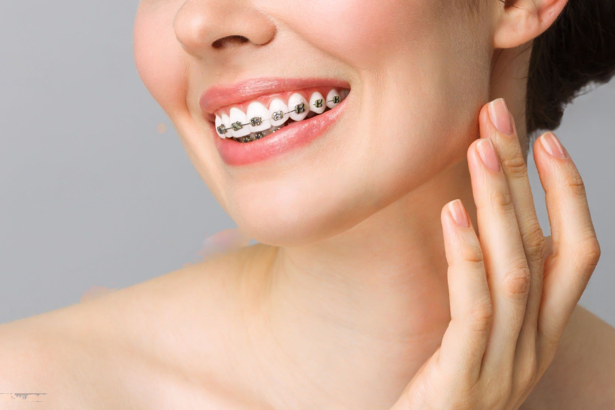 Dental Braces in Abu Dhabi Orthodontist in Abu Dhabi
