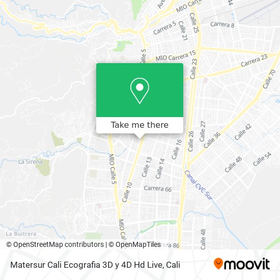Comment Aller A Matersur Cali Ecografia 3d Y 4d Hd Live A Santiago De Cali En Bus