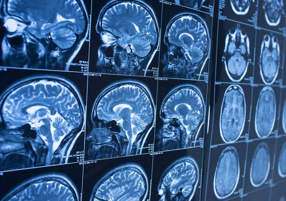 Full Body CT Scan Services NJ Edison, Elizabeth USA