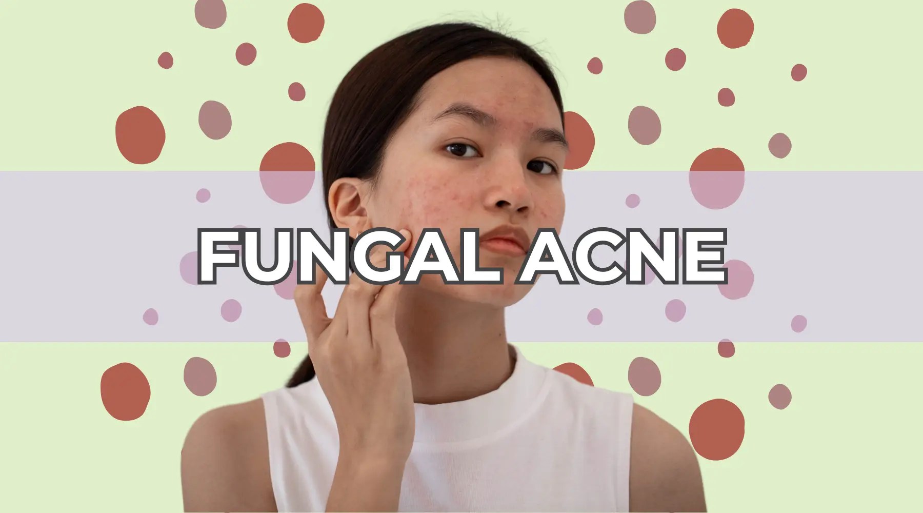 Understanding Fungal Acne Causes, Symptoms, and Treatment Aqneeq
