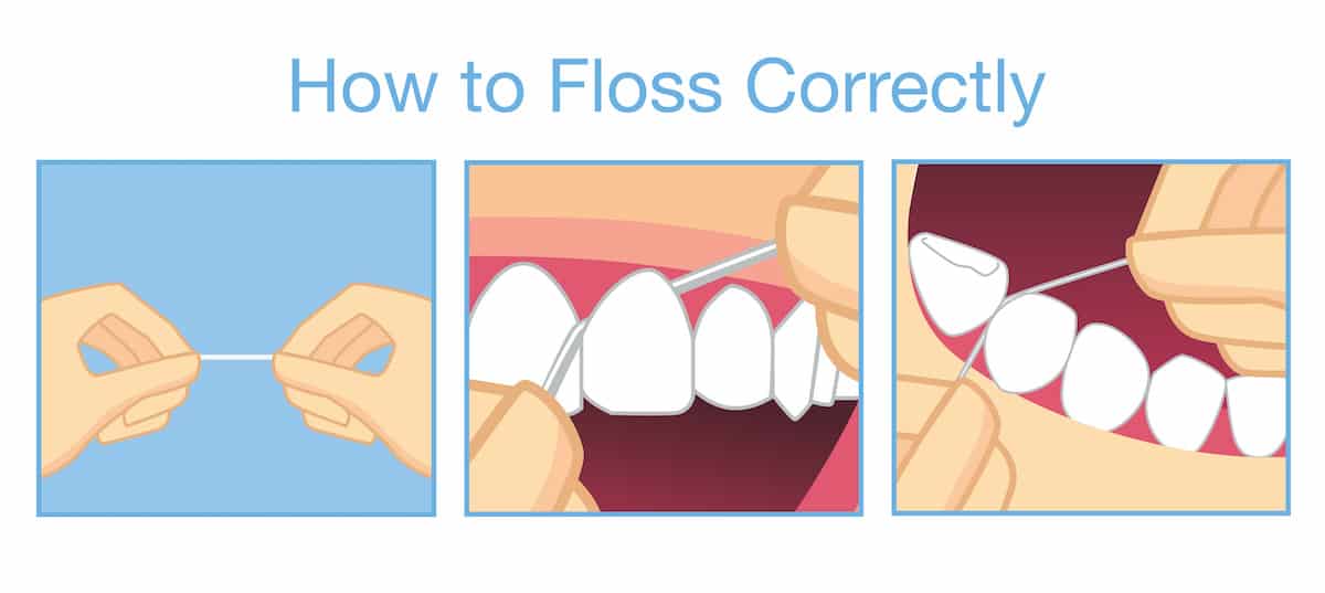 How To Pick The Best Floss To Use Caldwell, Bills, Petrilli & West