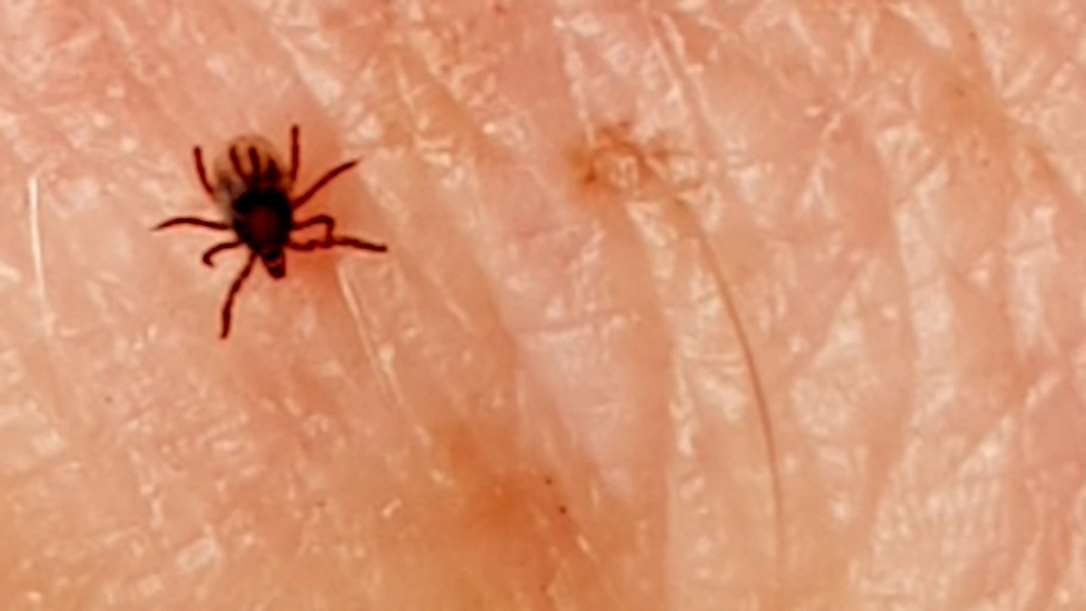 Ticks and Lyme disease Highlands of Scotland Arc guiding