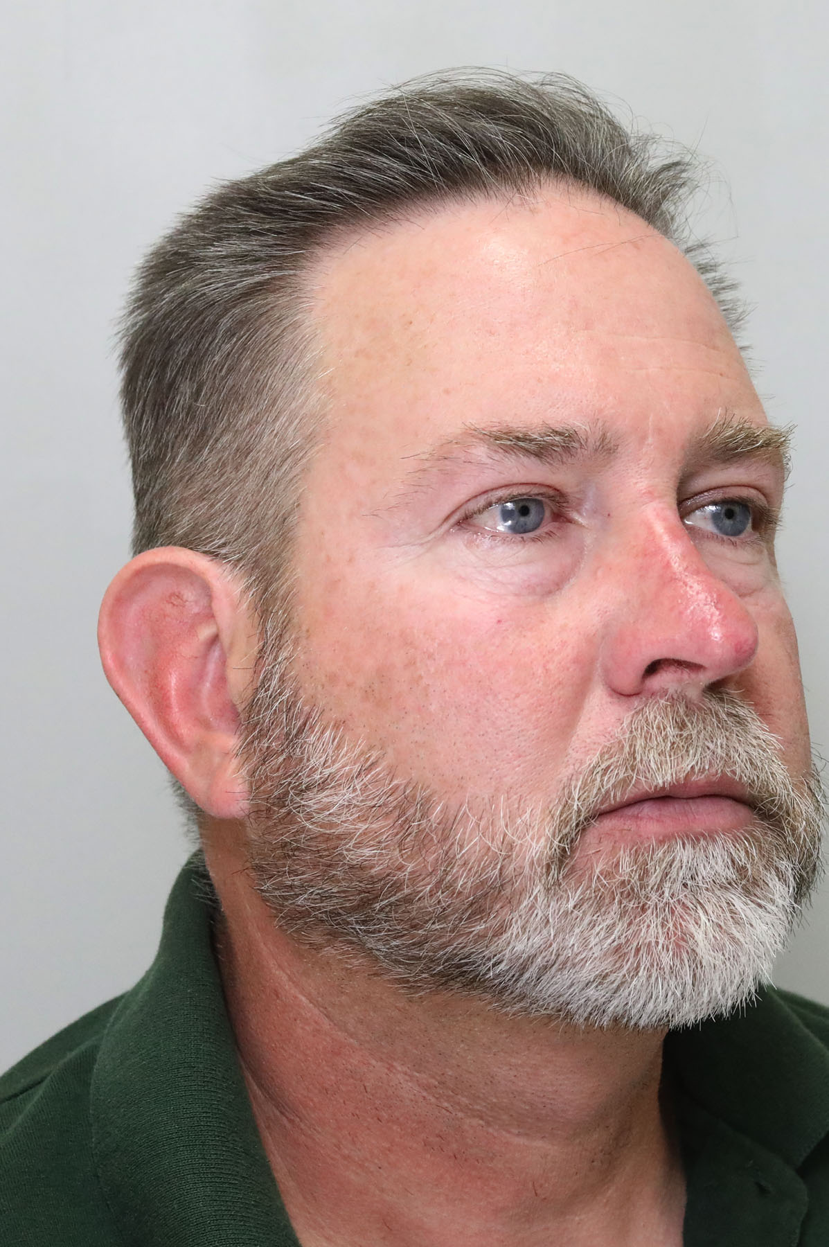 Case 3215 Center for Plastic Surgery