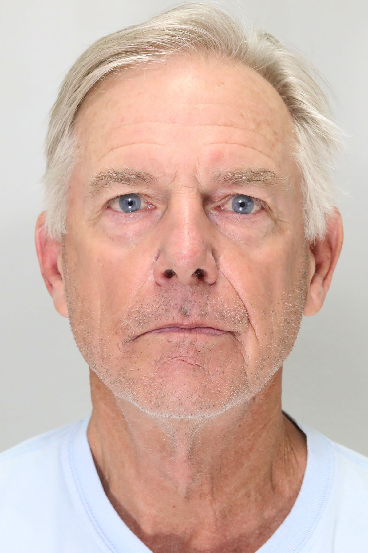 Neck Lift Archives Center for Plastic Surgery