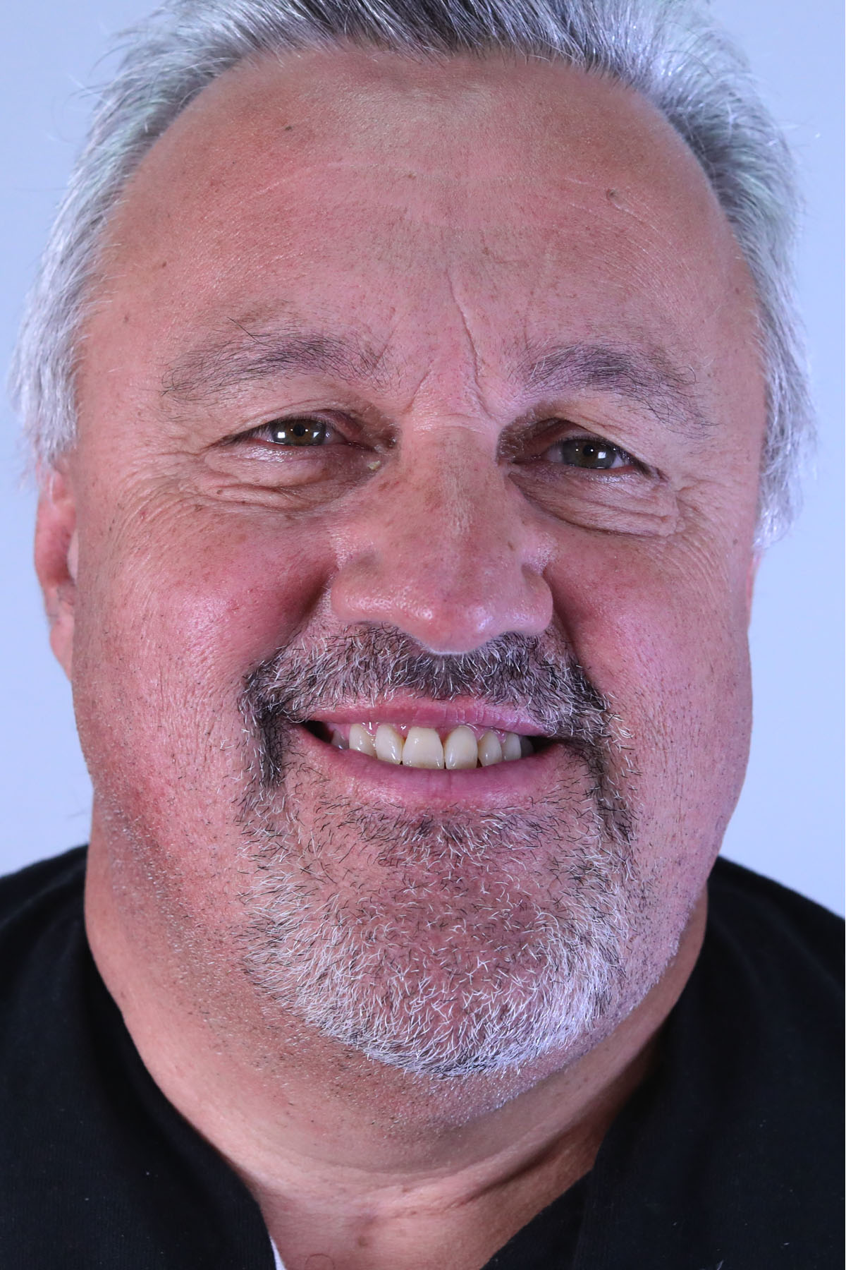 Neck Lift Archives Center for Plastic Surgery