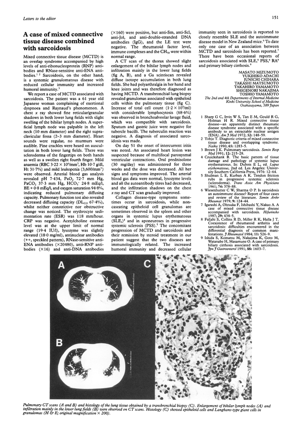A case of mixed connective tissue disease combined with sarcoidosis
