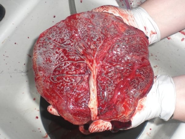 Qual é a verdadeira função da placenta na gravidez?
