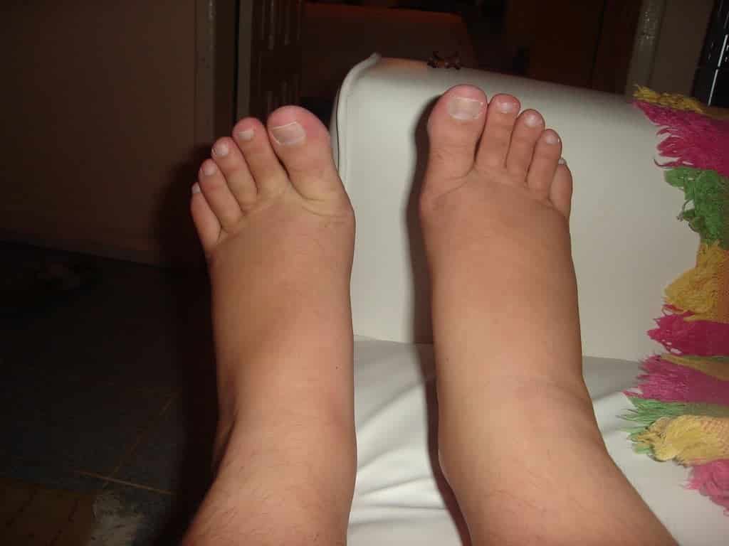 Pés de grávidas podem aumentar de tamanho para sempre