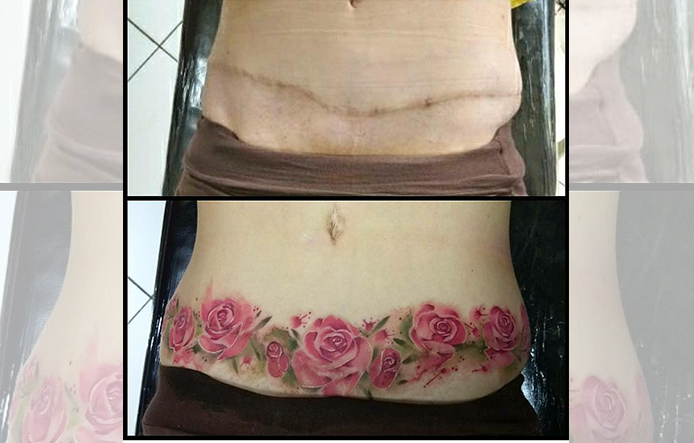 tatuagem em cicatriz de abdominoplastia Pesquisa Google Tattoos 40+ Mejores Colecciones Tatuagem Para Disfarcar Cicatriz De
