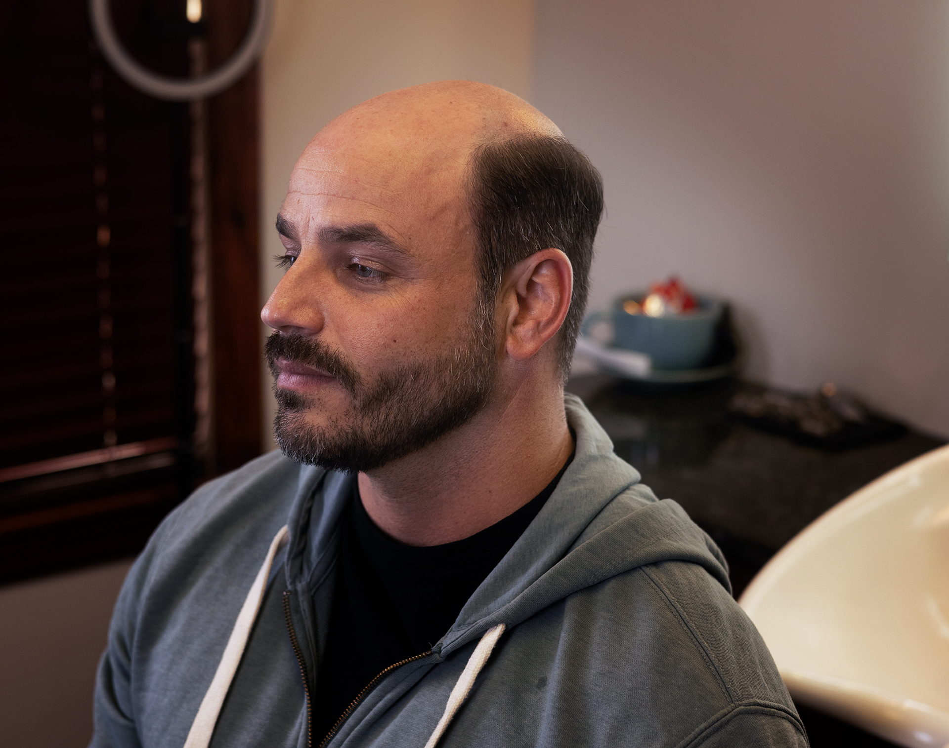 Nonsurgical Hair Restoration Services Salt Lake City & Bountiful Utah