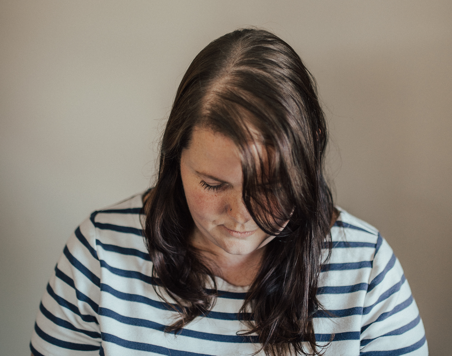 Nonsurgical Hair Restoration Services Salt Lake City & Bountiful Utah