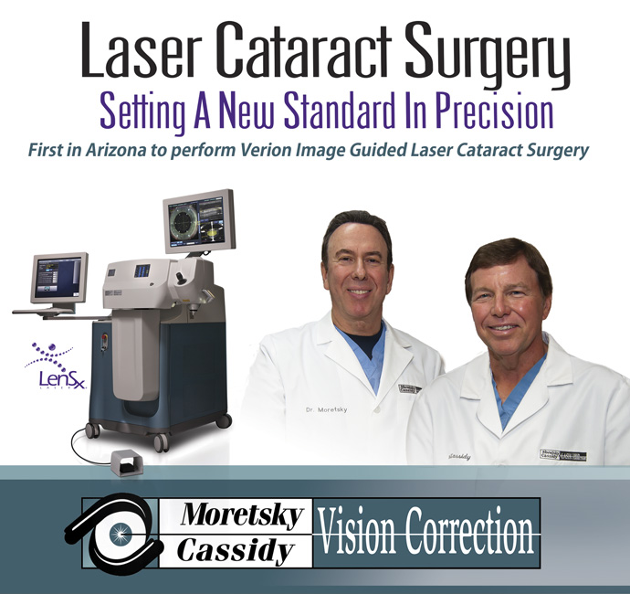 Laser Cataract Surgery Arizona (AZ) Moretsky Cassidy Vision Correction