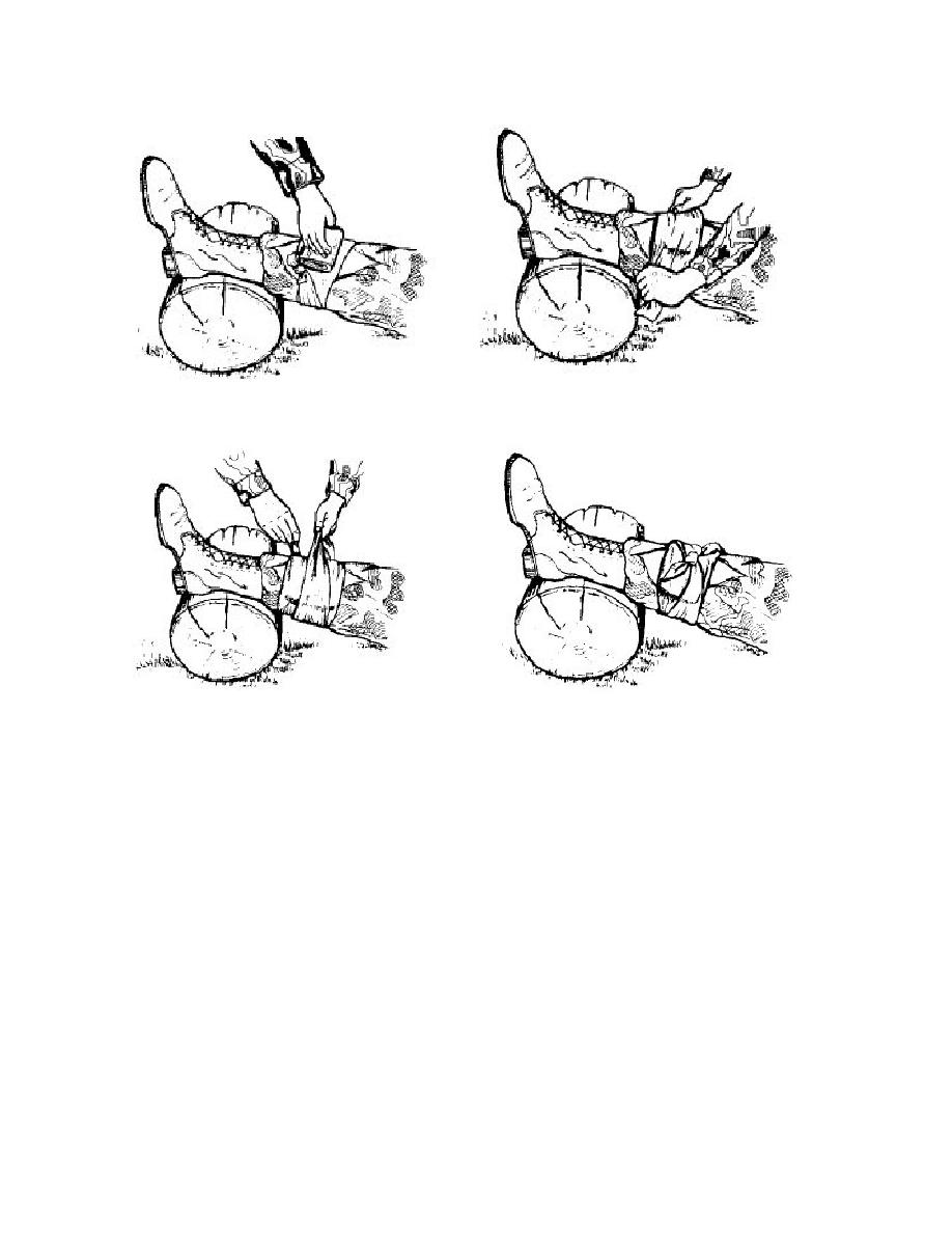 Figure 510. Applying an improvised pressure dressing