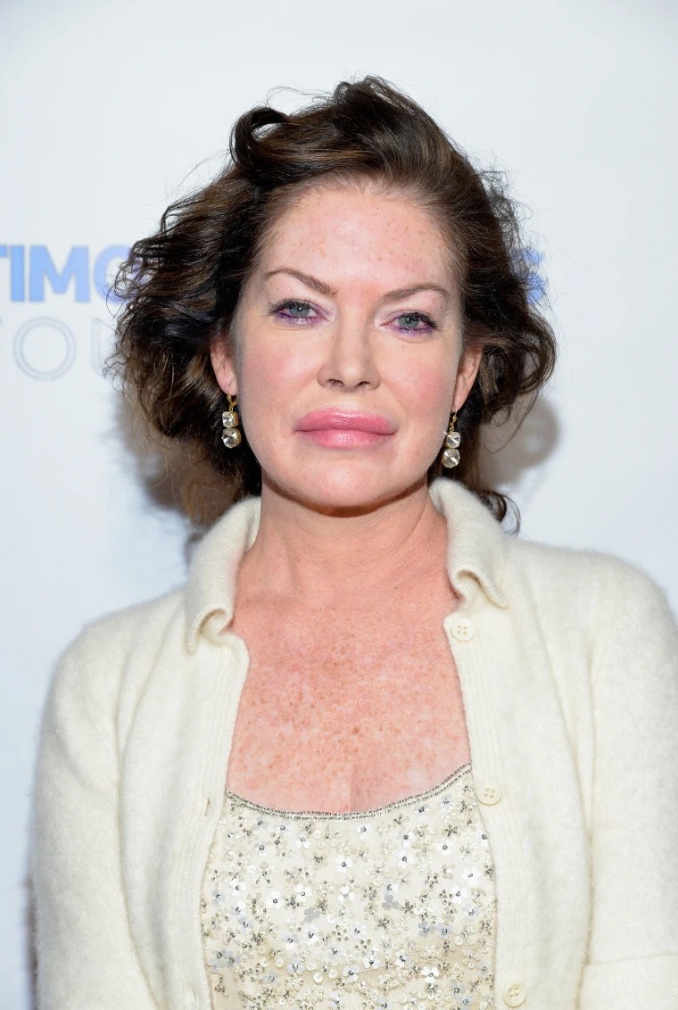 Another plastic surgery, another ruined face… Check out how Lara Flynn