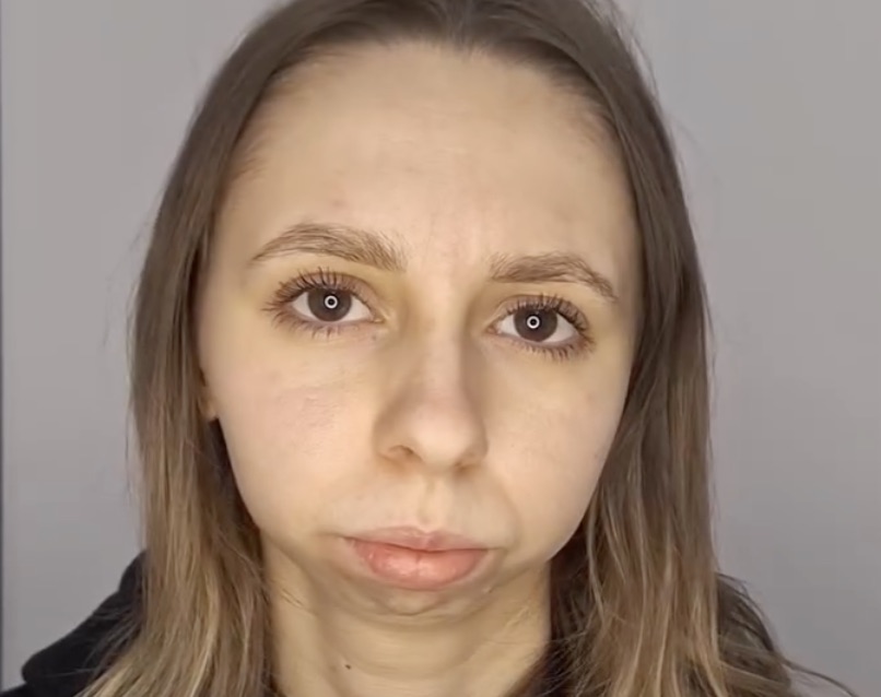 She Made One Change on Her Face, NOT Her Chin, And Looks Completely