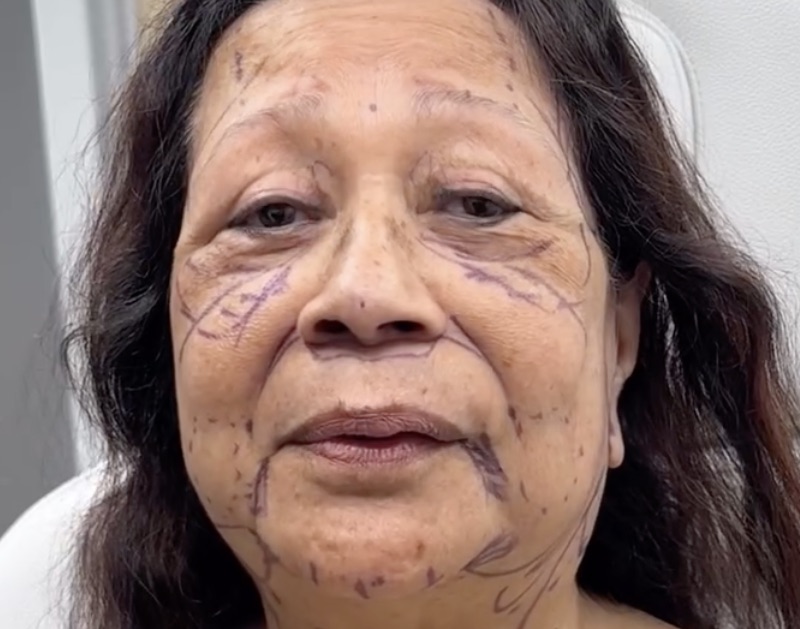 This Old Grandma Got a Facelift and She Looks 20 Years Younger After(01)