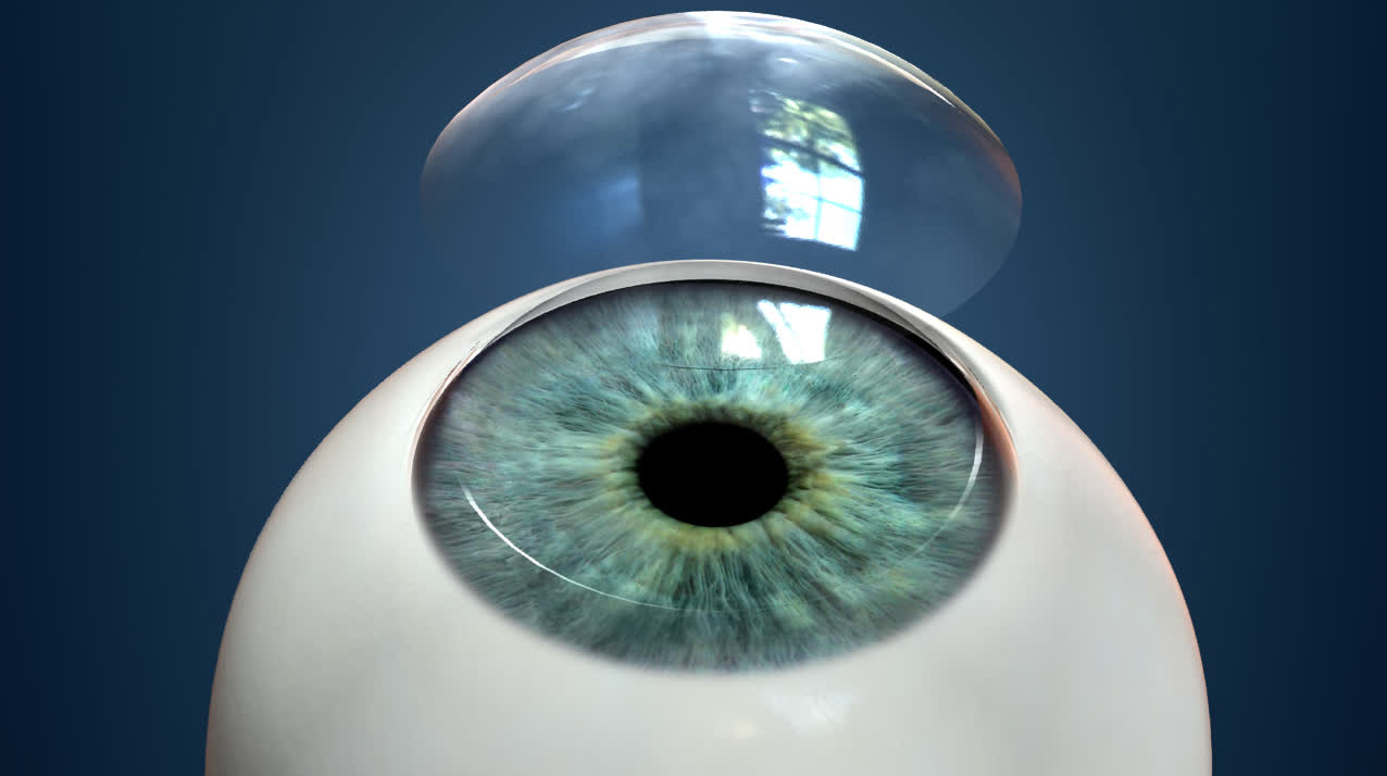 Best Cornea Specialist & Transplant Doctors in Karnal Arora Eye Centre