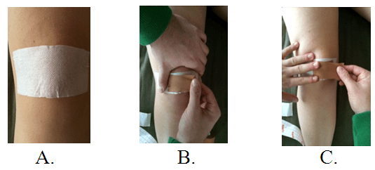 The Use of Therapeutic Taping in Individuals with Patellar Tendinopathy