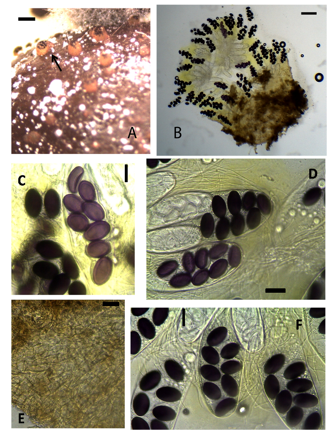Morphological Diversity of Ascobolus and Pilobolus Fungi from Wild