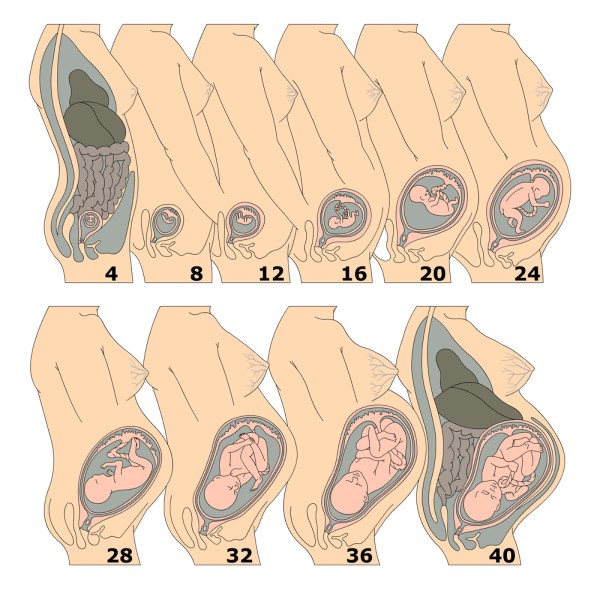 Acid Reflux During Pregnancy