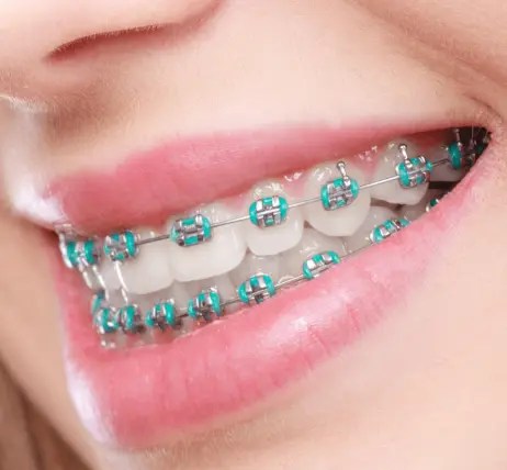 688a2b5e6417b.webp