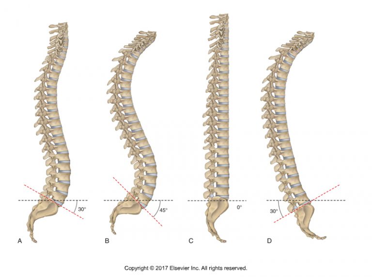Elongation of the Spine Art of Control