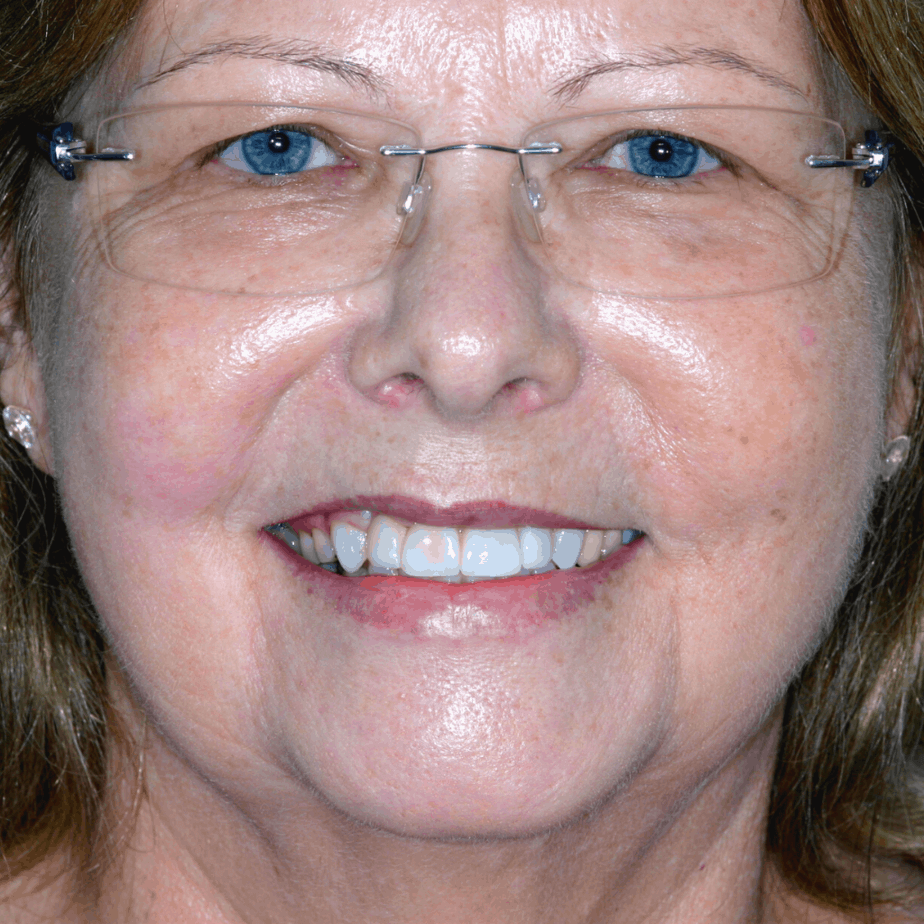 ArtSmiles Cosmetic Dentist Gold Coast Anti Ageing Dentistry