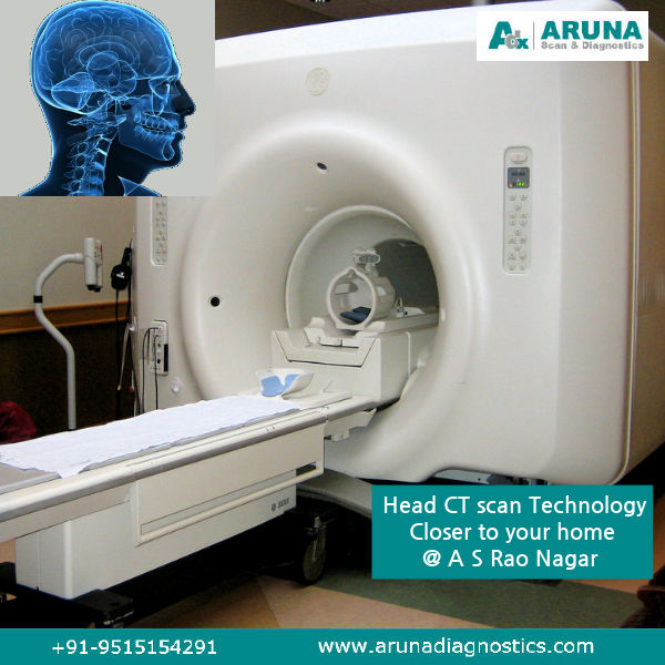 Aruna Scan and Diagnostics Center MRI Scanning CT Scanning