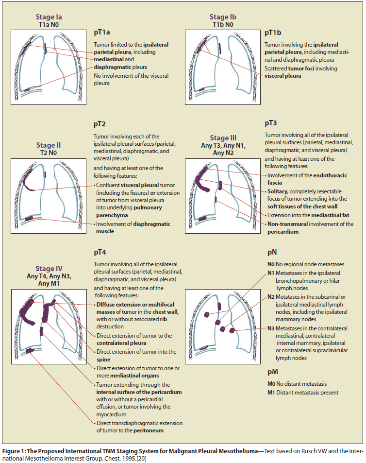 Chest X Ray Copd
