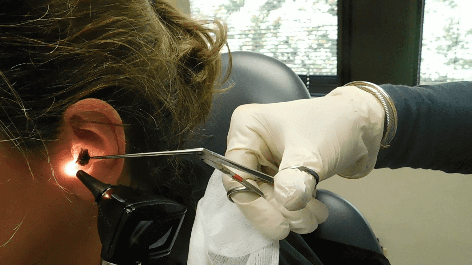 Is Earwax Bad and How Do I Remove It?