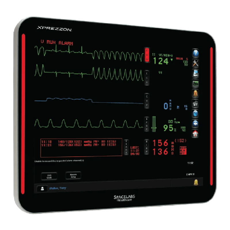 Highend Bedside Patient Monitors Aseptic Ventures