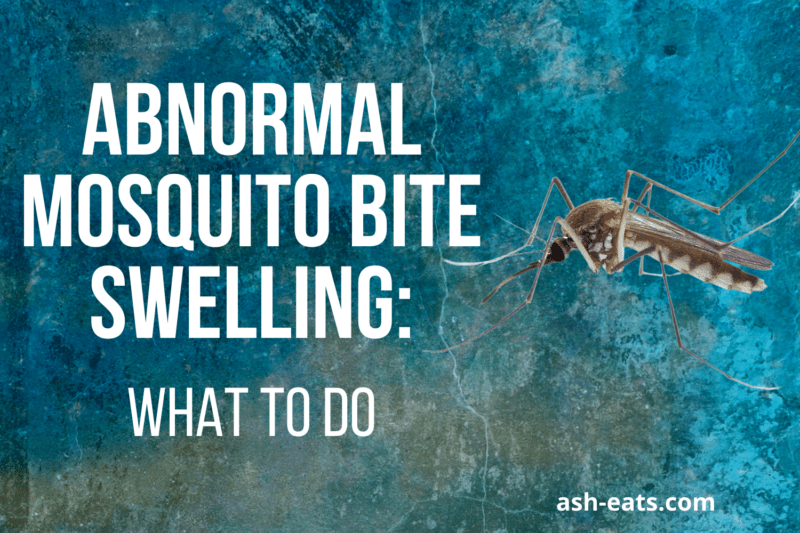 Abnormal Mosquito Bite Swelling What To Do Ash Eats
