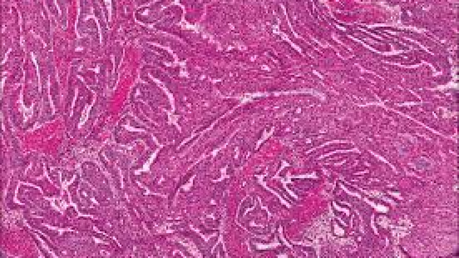 Histopathology with frozen section Asheesh Pathology Lab