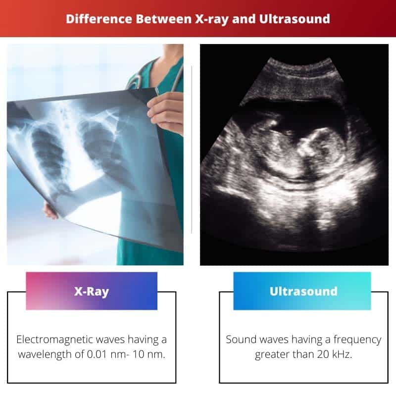 Xray vs Ultrasound Difference and Comparison