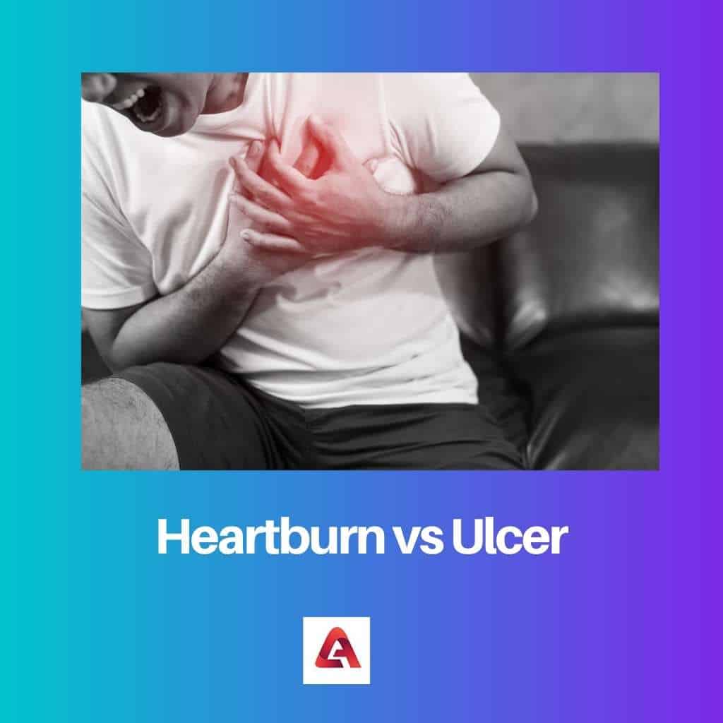 Heartburn vs Ulcer Difference and Comparison