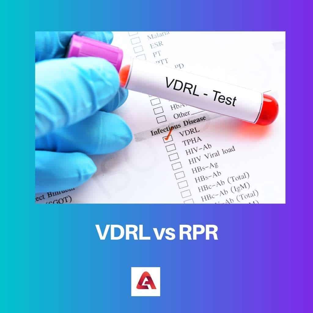 VDRL vs RPR diferencia y comparación