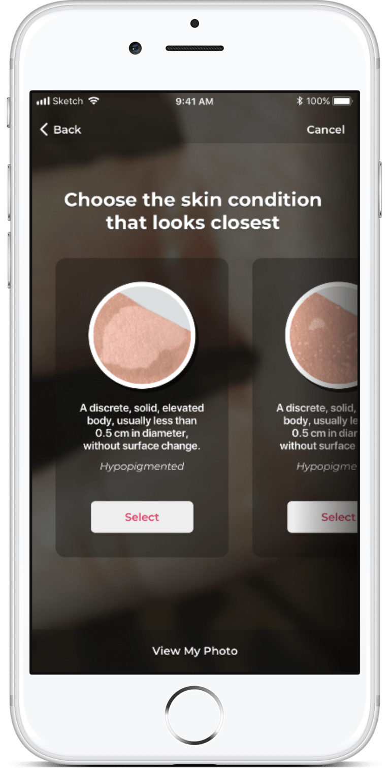 Skin Condition Questions? AIEnabled Answers » Ask Aysa