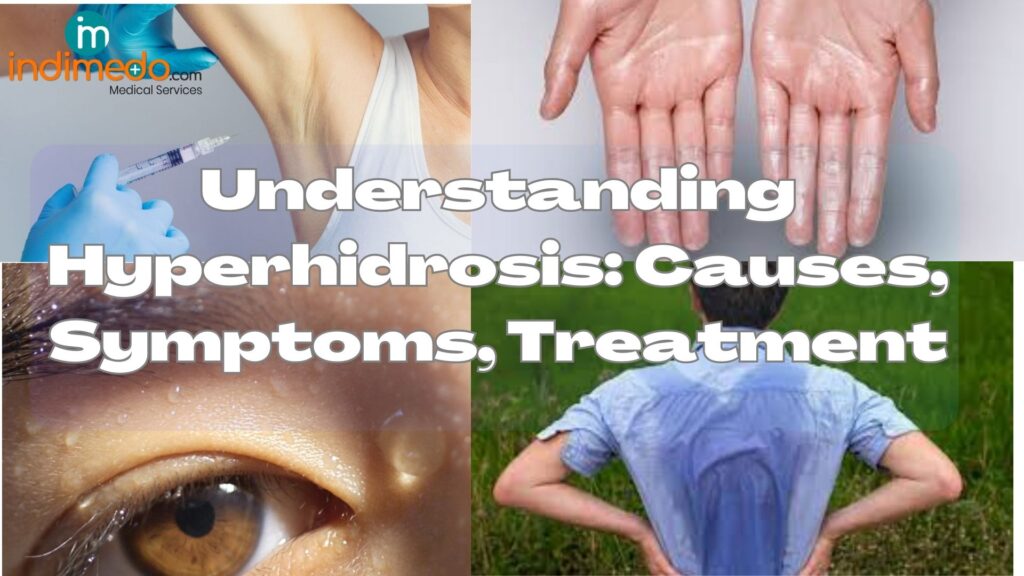 Understanding Hyperhidrosis Ask The Nurse Expert