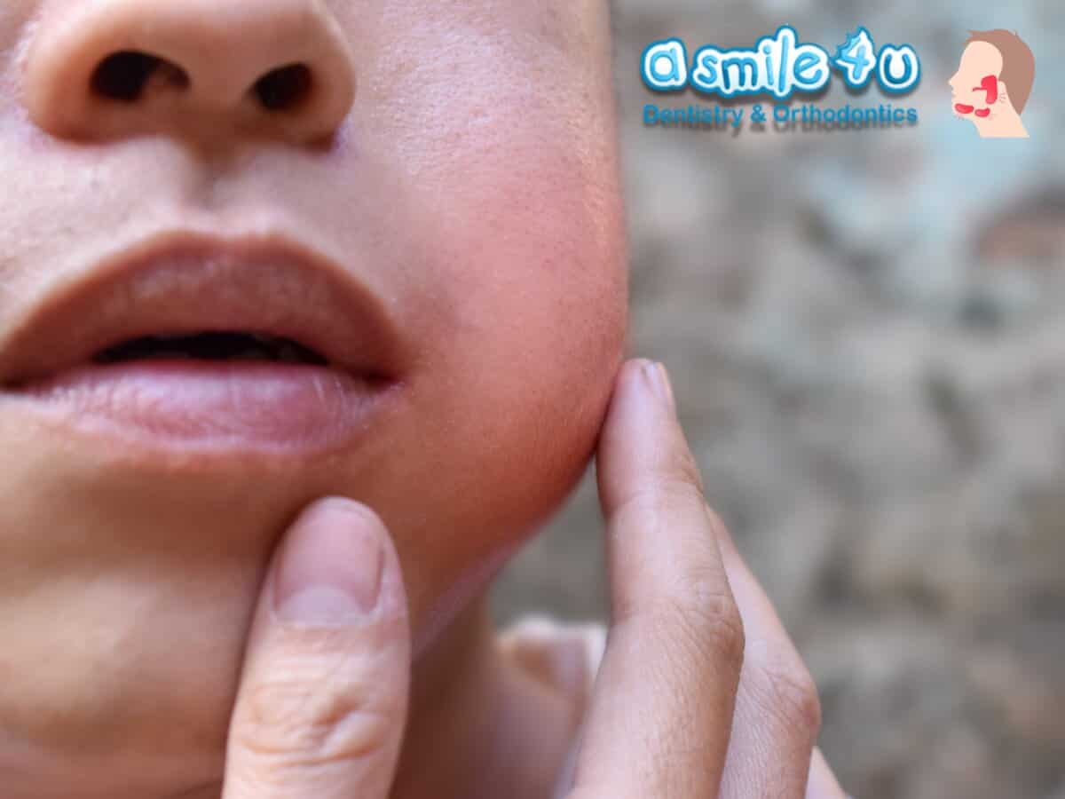 Jaw Tumors and Cysts Causes and Treatments A Smile 4 U