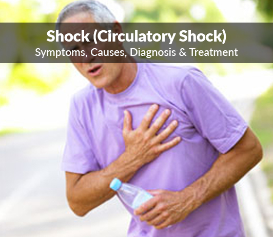 Shock (Circulatory shock) Symptoms, Causes, Diagnosis & Treatment