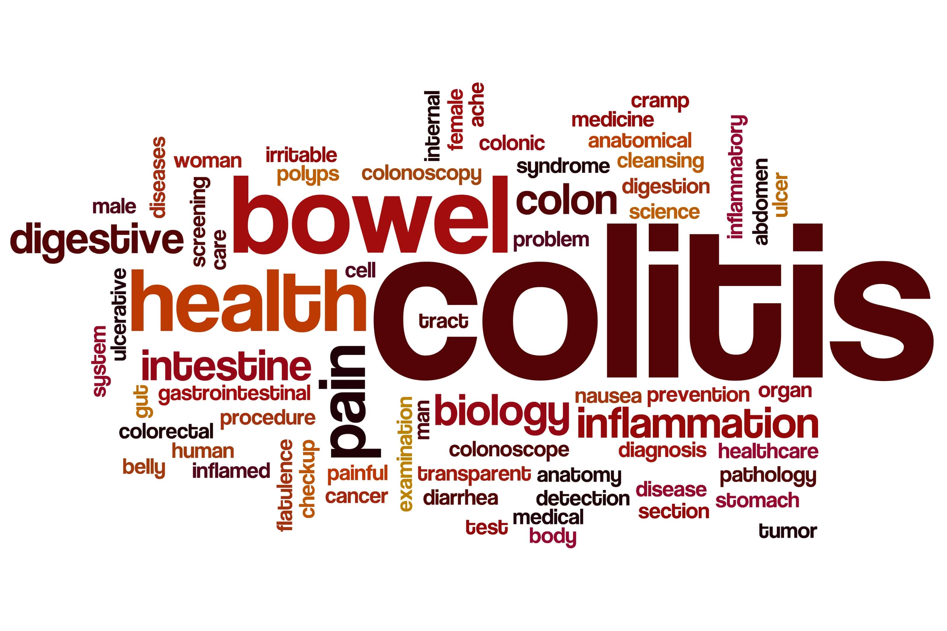 Article What is Ulcerative Colitis?